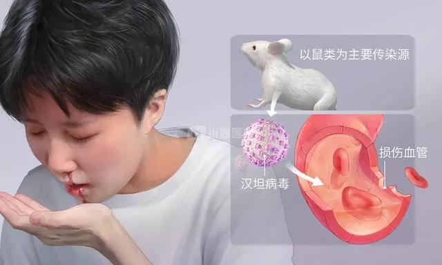 西安为什么高发出血热（西安出现多例出血热）(6)