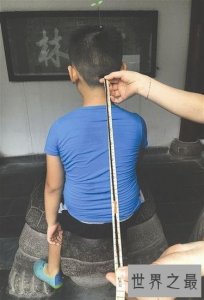 世界上胎毛最长的人,留9年长60厘米