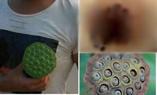 莲蓬乳是怎么形成的 莲蓬乳图片其实都是假的