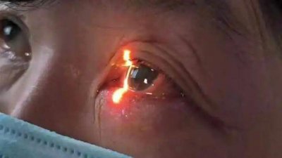 头疼不一定是“阳”了!女子硬熬好几天,差点失明