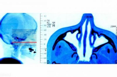 ​耳鼻喉科症状学，耳鼻喉科学科发展规划