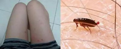 ​家里放一物绝对没跳蚤（发现家里有跳蚤应该怎么做）