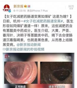 ​什么减肥运动效果最好(怎么运动减肥效果快又好)