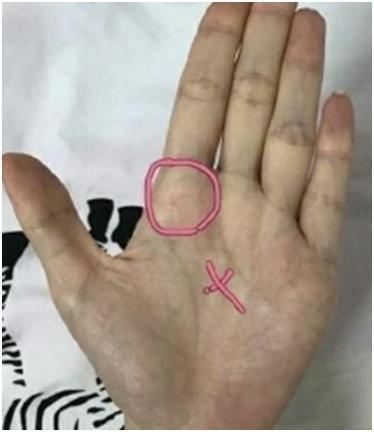 非常少见的“豪宅纹”手相, 可不是你想的那样