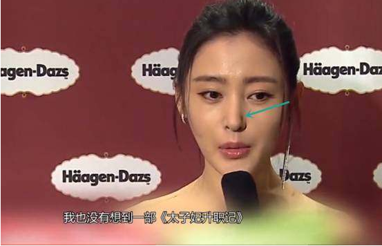 张天爱没整容呀对比 张天爱整过鼻子吗